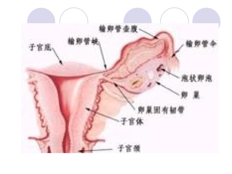 卵巢囊肿(腹腔镜手术)护理查房.ppt课题_第4页