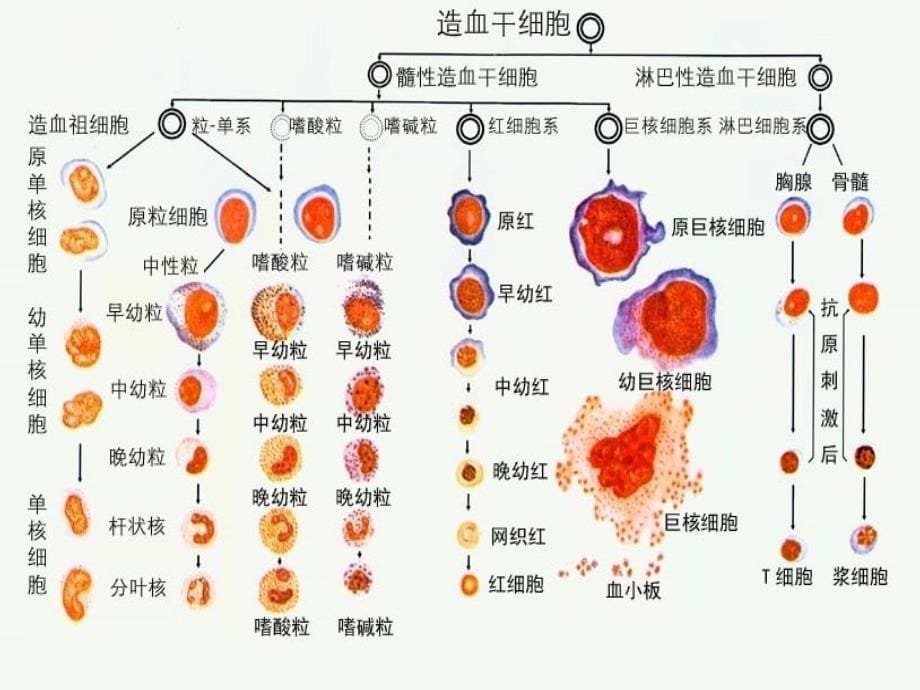 白血病病人的护理-课件_第5页