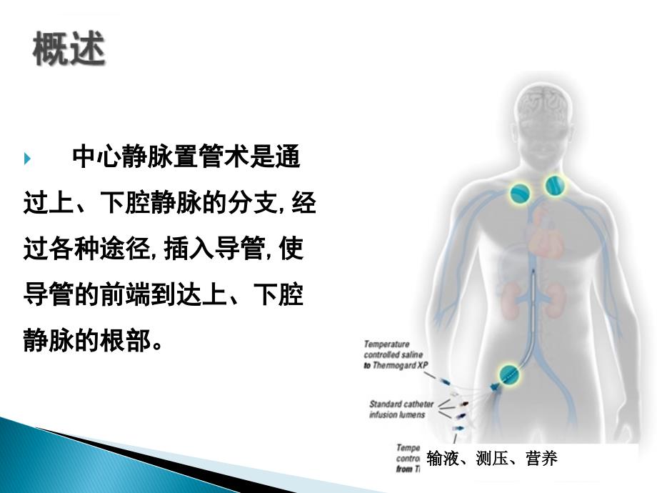 中心静脉置管护理ppt课件116_第4页