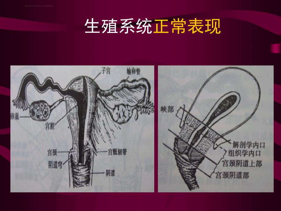 医学影像诊断ppt图文详解完整版生殖系统影像学_第3页