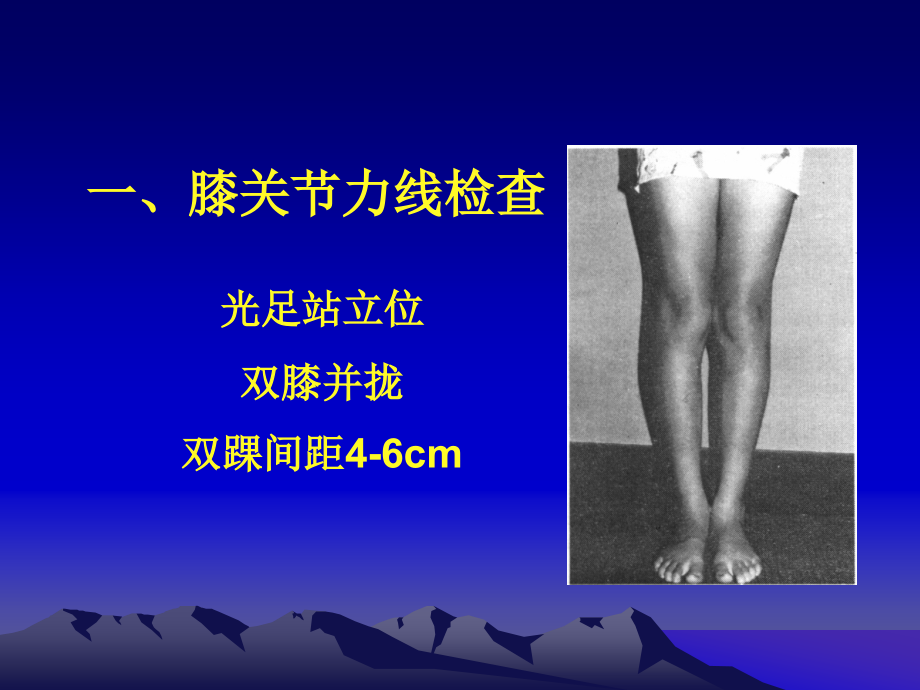 膝关节体格检查2_第3页