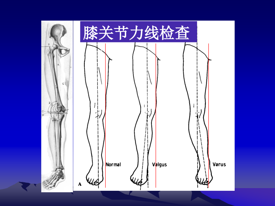 膝关节体格检查2_第4页