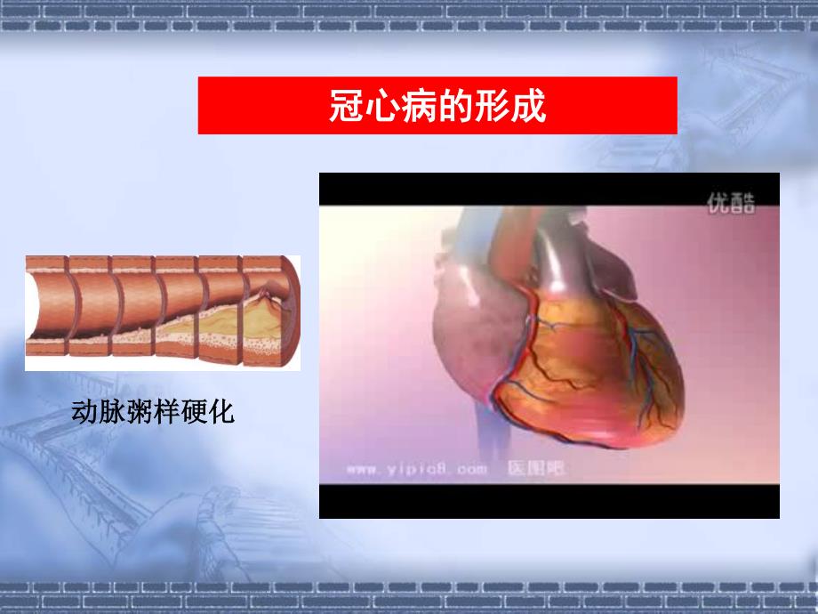 第八讲 常见意外伤害的家庭处理(冠心病、脑卒中).pdf_第4页