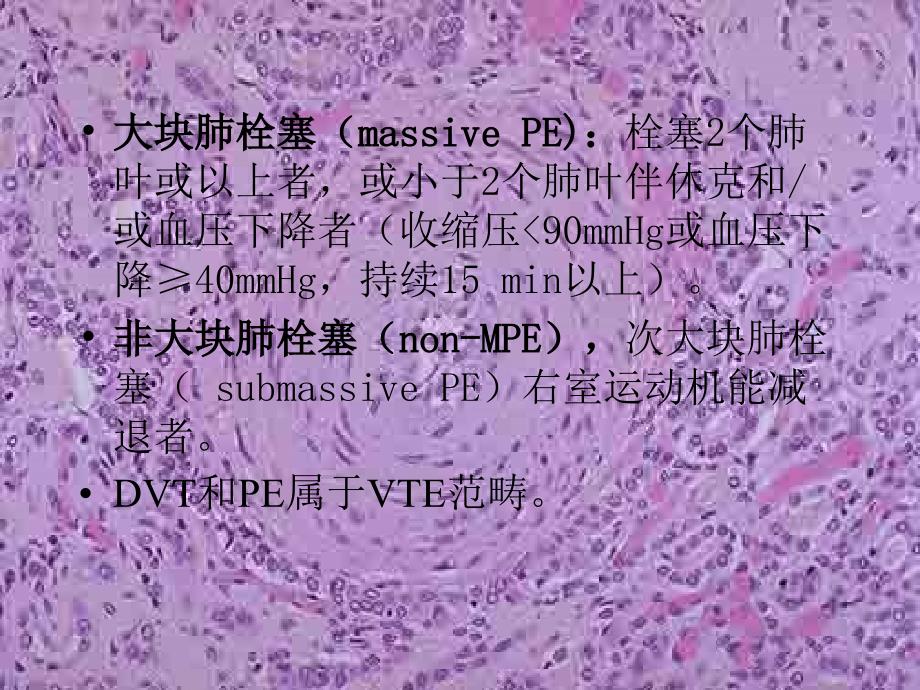 肺动脉血栓形成_第3页