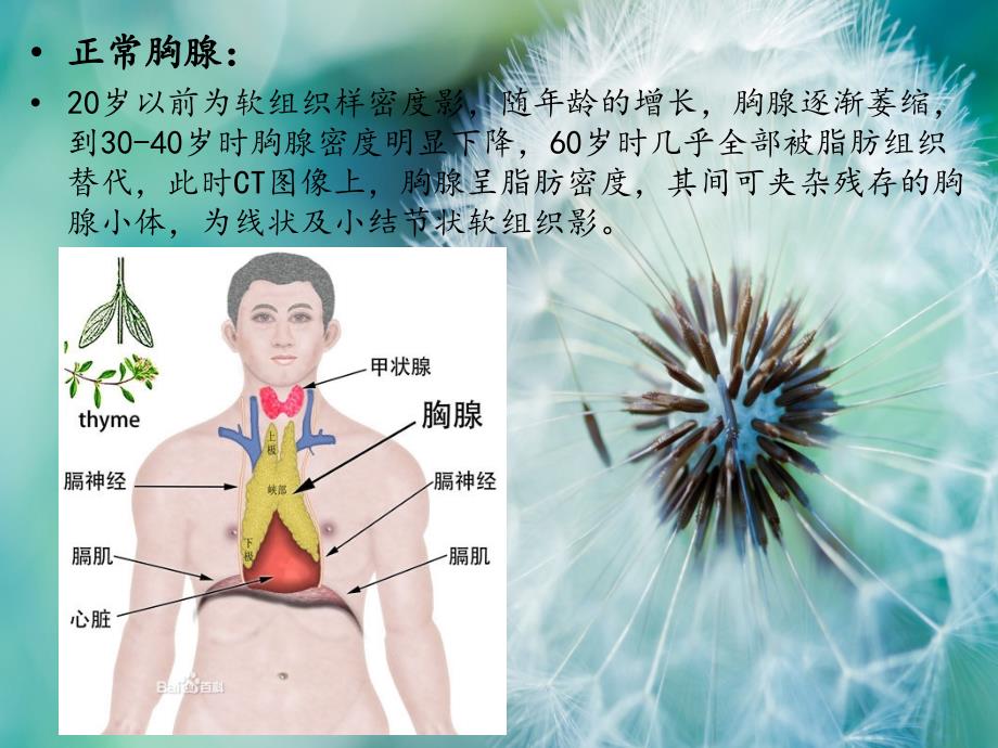 胸腺瘤ppt.ppt_第4页