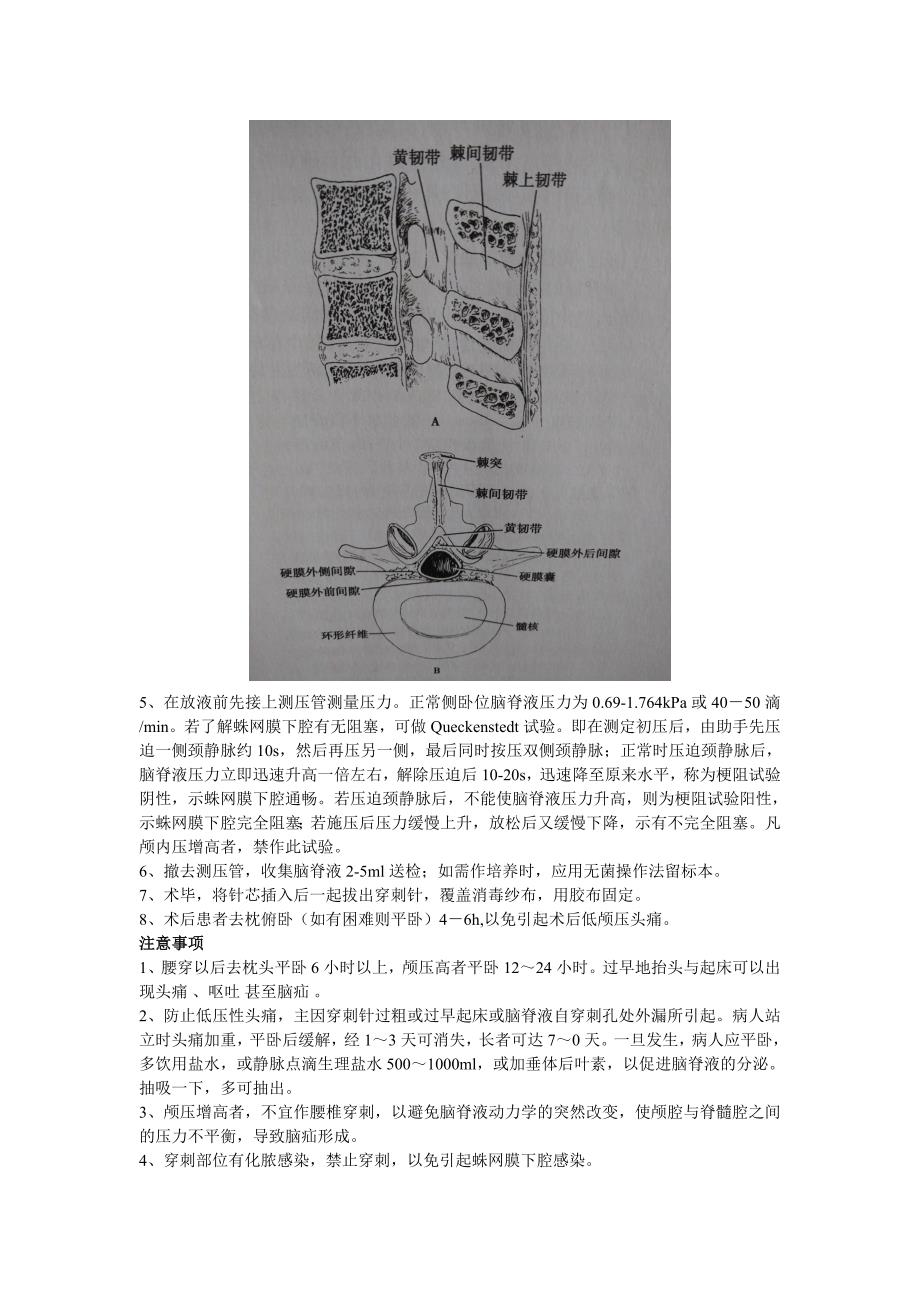 腰椎穿刺术及训练模型.doc_第4页