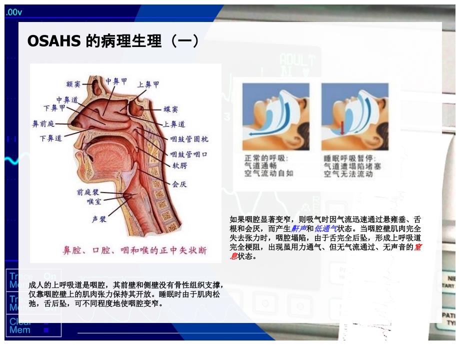 OSAHS专家共识.ppt_第4页