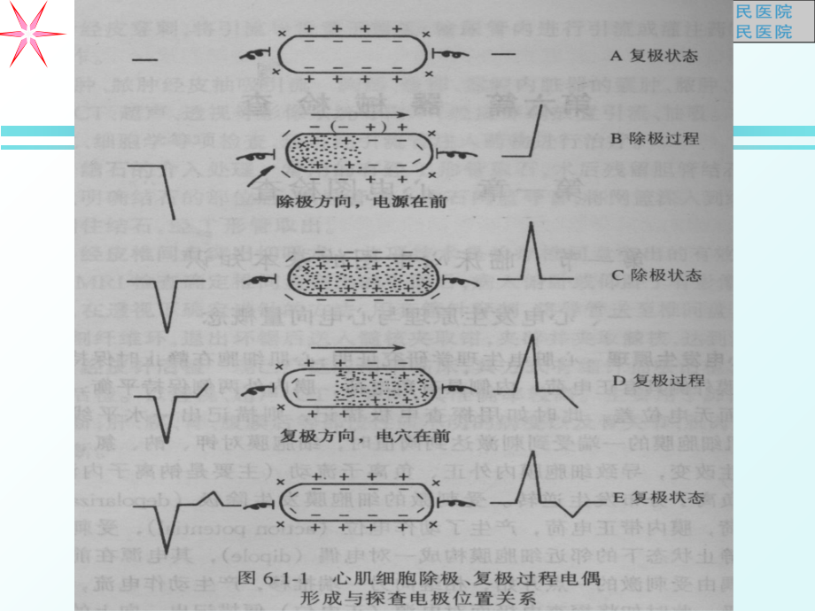 心电图讲义2课件_第4页