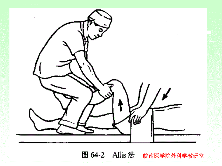 骨折各论-下肢骨关节损伤课件_第2页