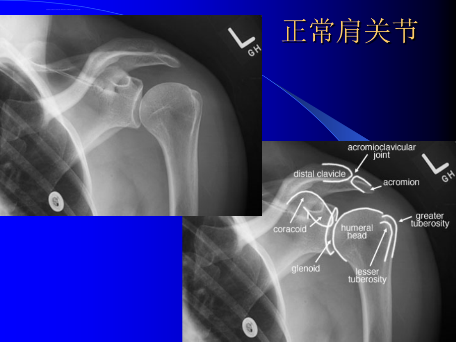 骨科x线片教学(精)课件_第2页