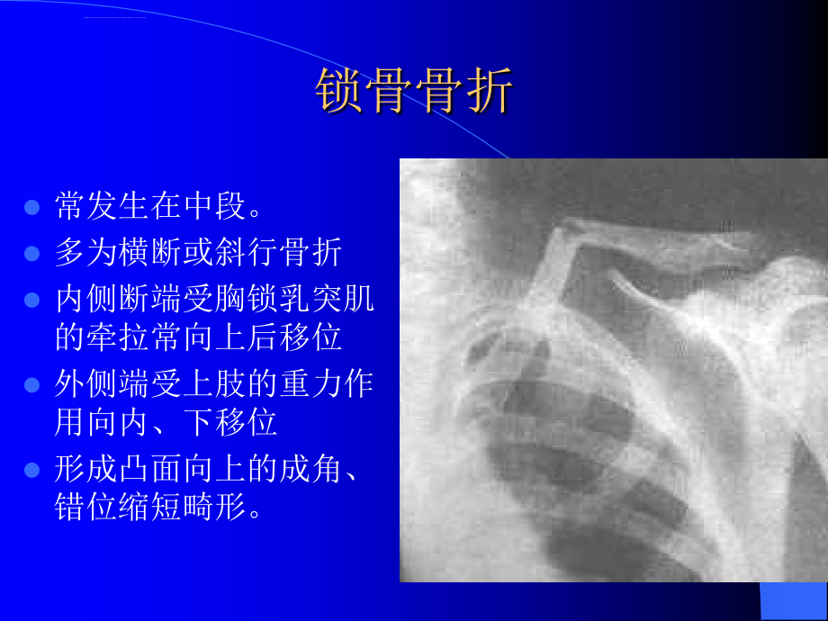 骨科x线片教学(精)课件_第3页