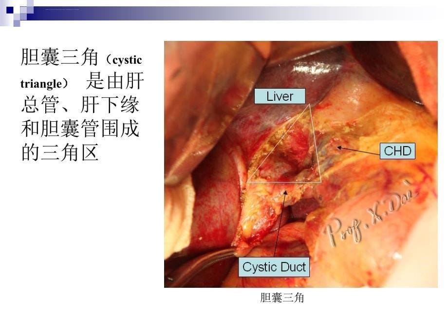 胆道疾病ppt文档课件_第5页