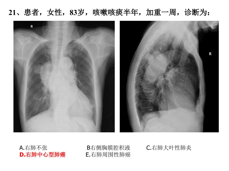 x线试题及答案_第1页