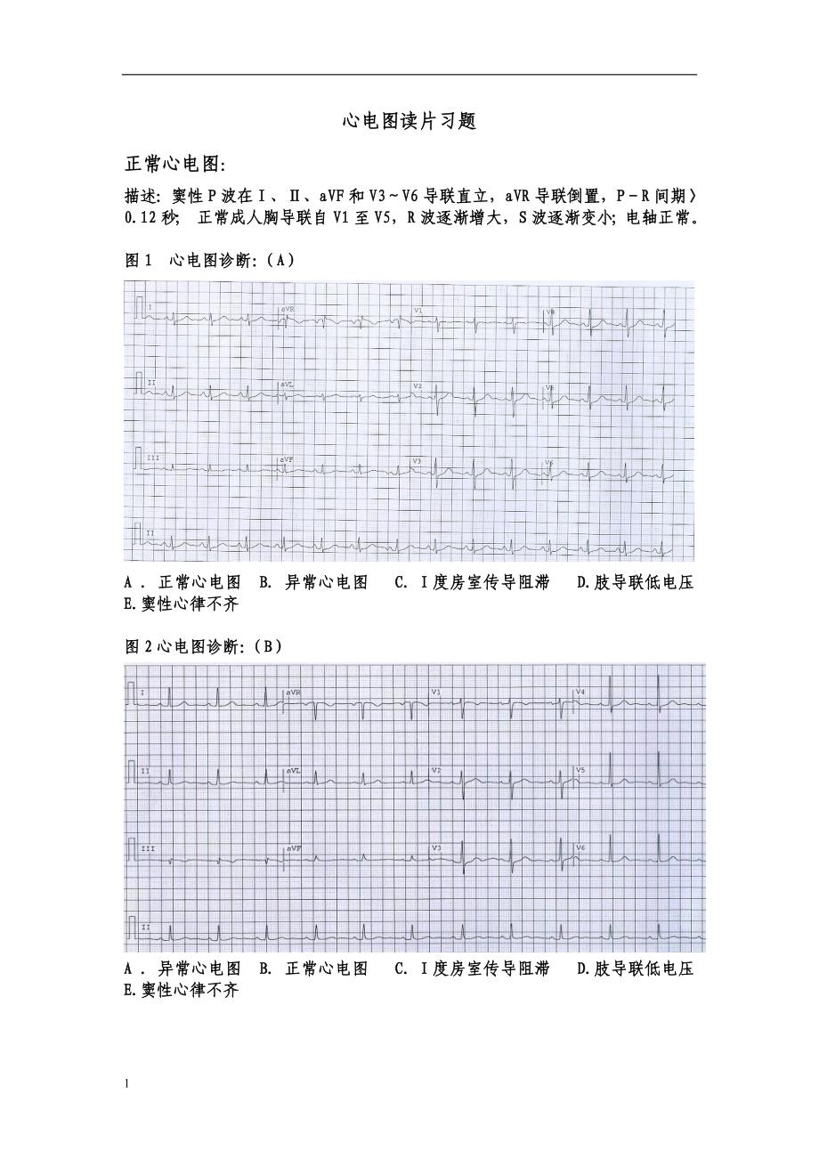 心电图 规培练习_第1页