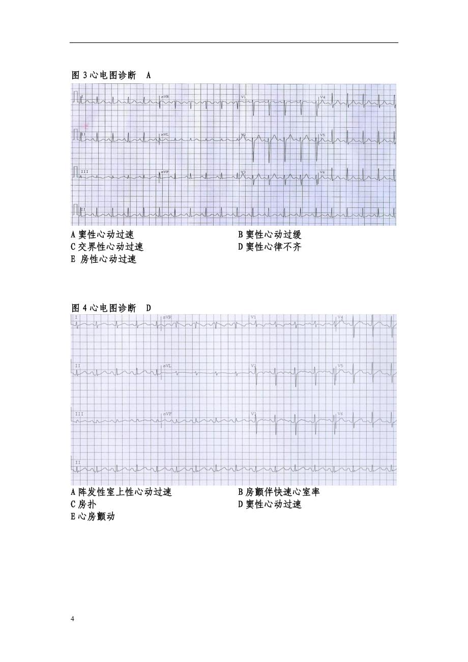 心电图 规培练习_第4页