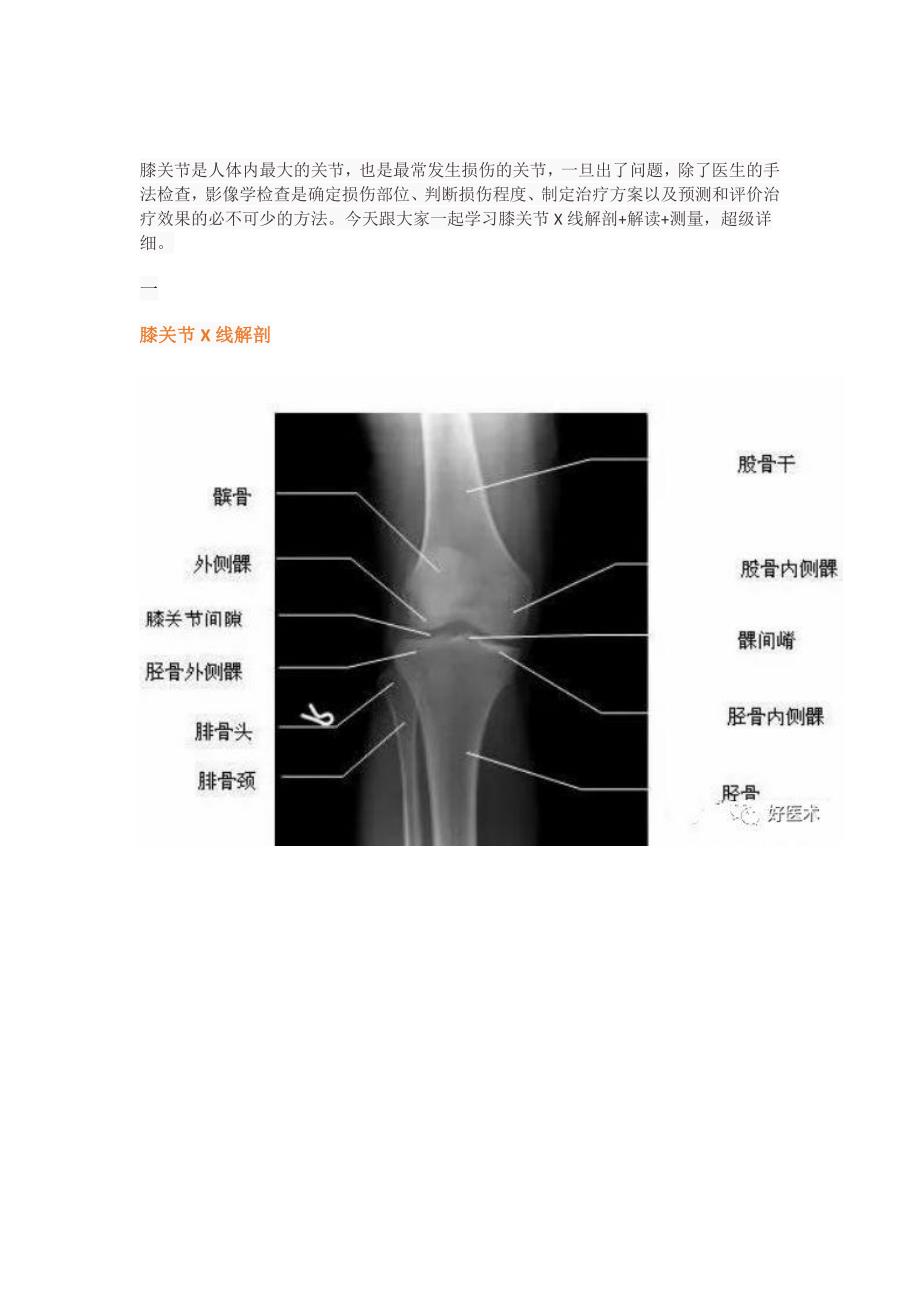 超详细的膝关节x线解剖及测量_第1页