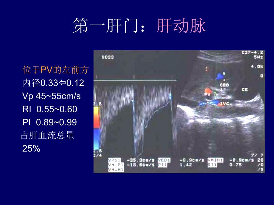 影像_b超_图谱 -肝胆超声诊断学_第2页