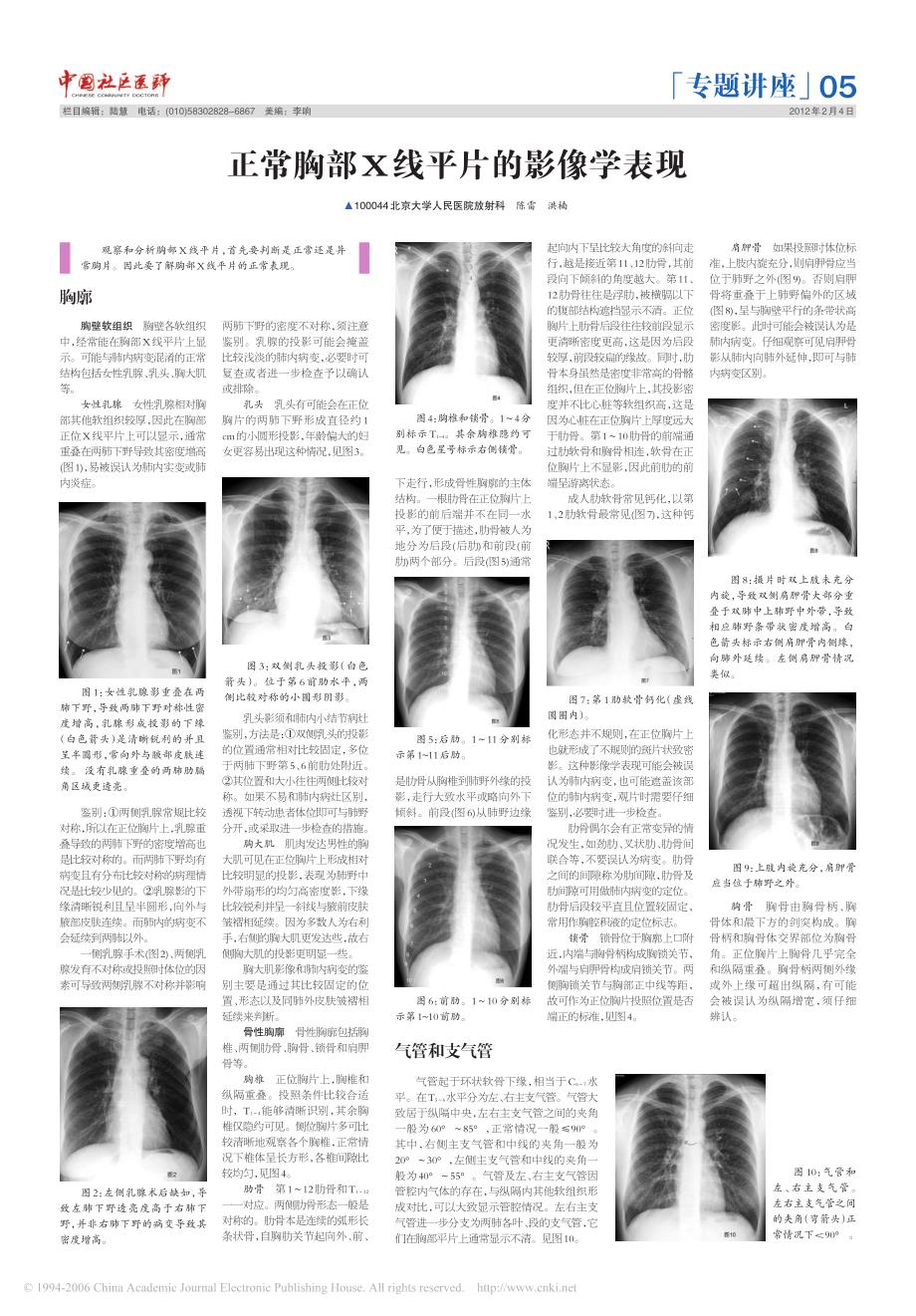 正常胸部x线平片的影像学表现_第1页