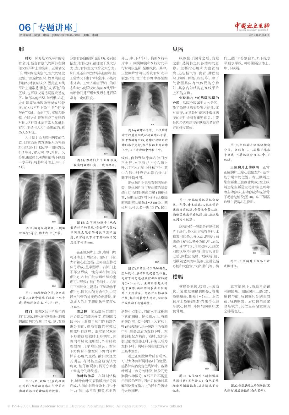 正常胸部x线平片的影像学表现_第2页
