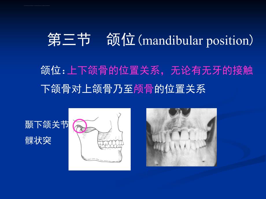 牙列牙合与颌位（颌位）课件_第2页