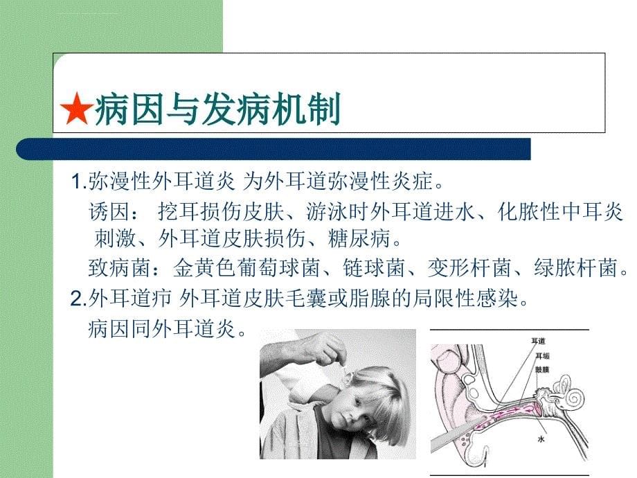 耳科病人的护理课件_第5页