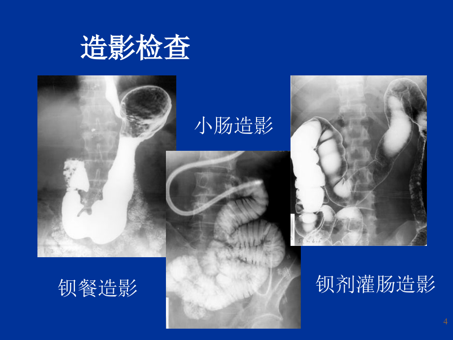 消化系统影像诊断-工程幻灯片_第4页