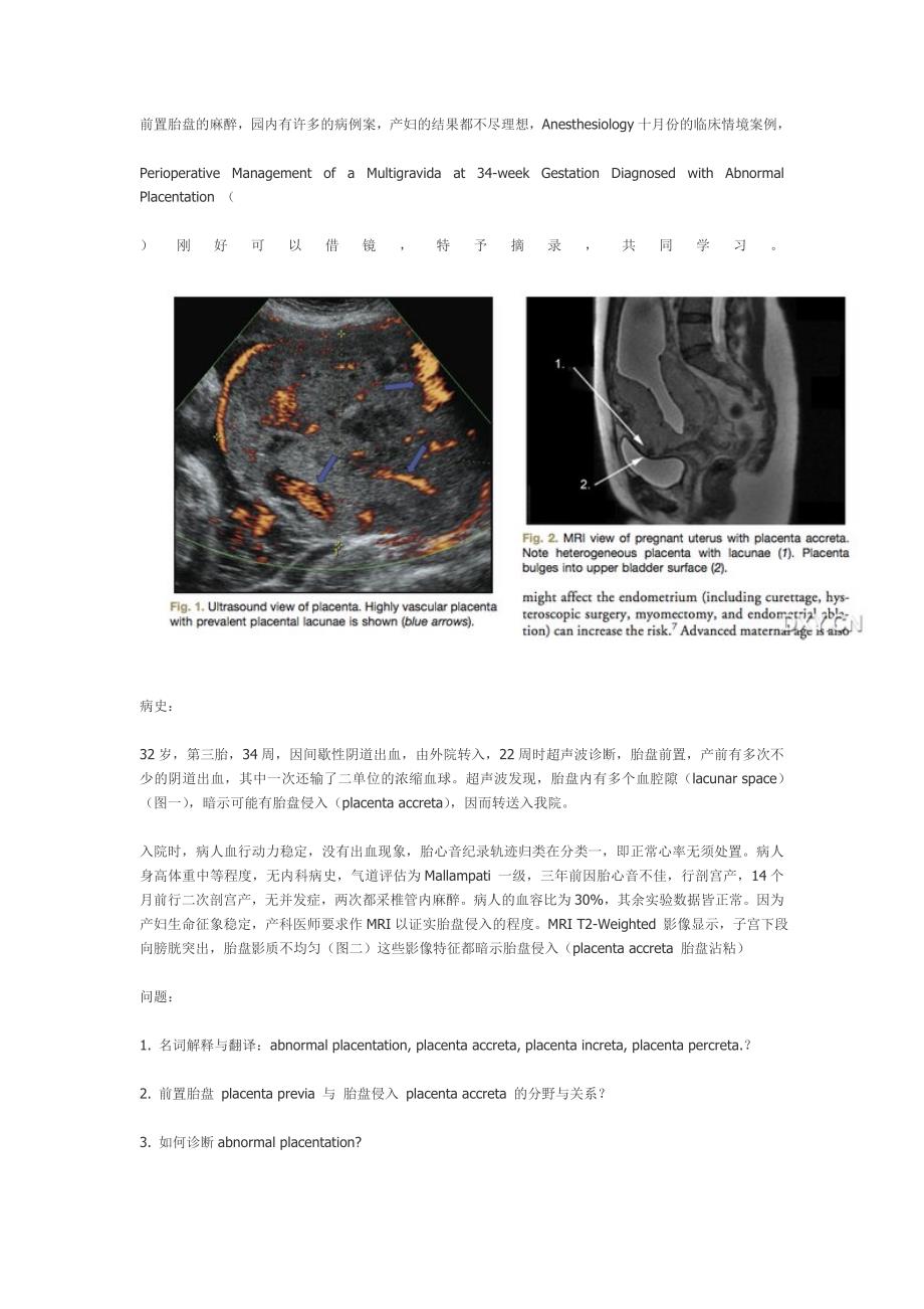 前置胎盘的麻醉_第1页