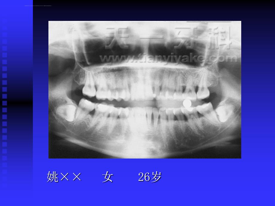 牙周健康讲座广州天一牙科诊所--刘剑课件_第4页