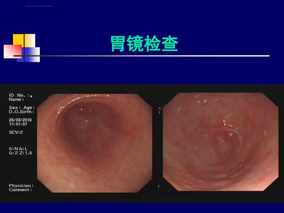 消化系统常见病ppt课件_第4页