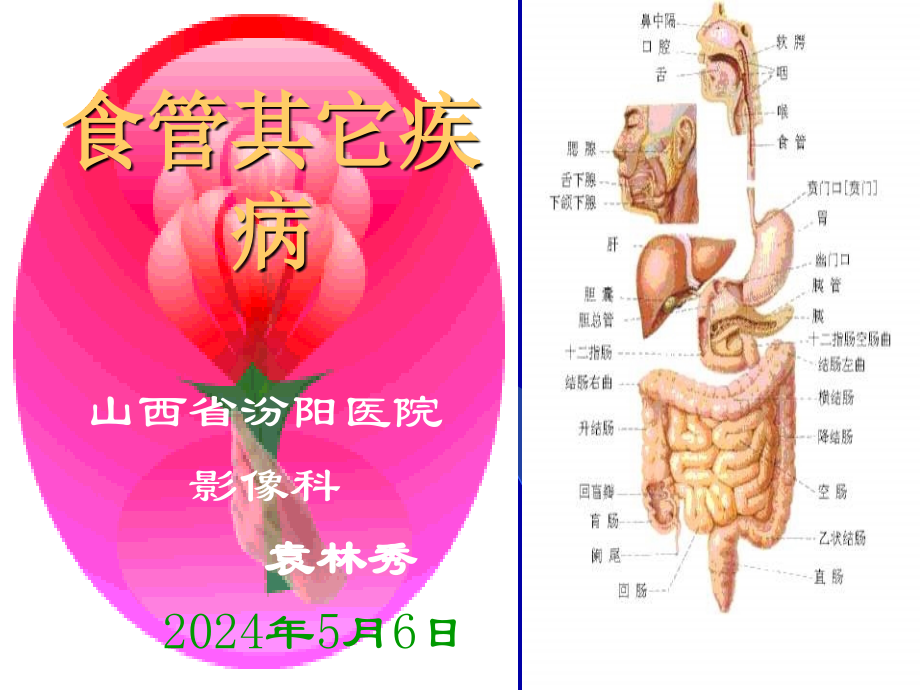 《食管它疾病》课件_第1页