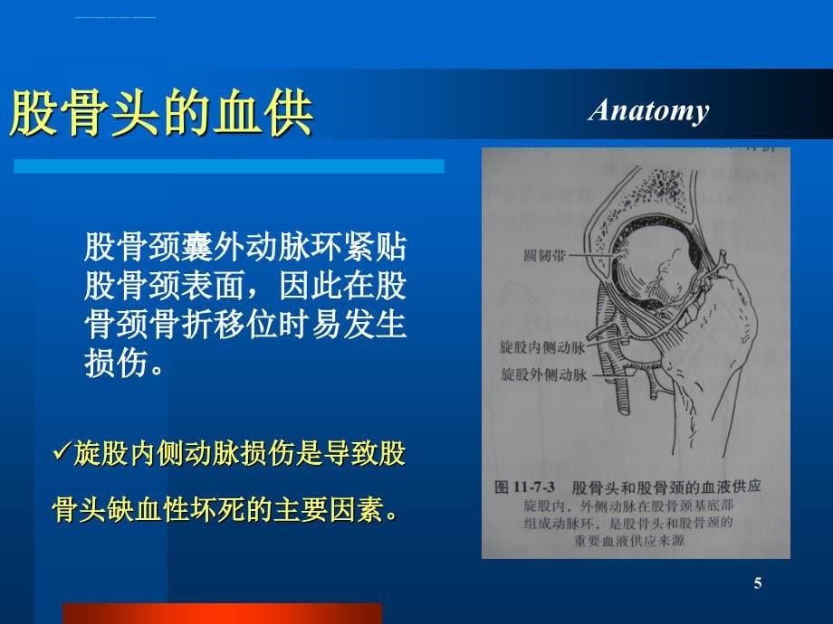 股骨颈骨折ppt-〖精品幻灯片〗(1)_第5页