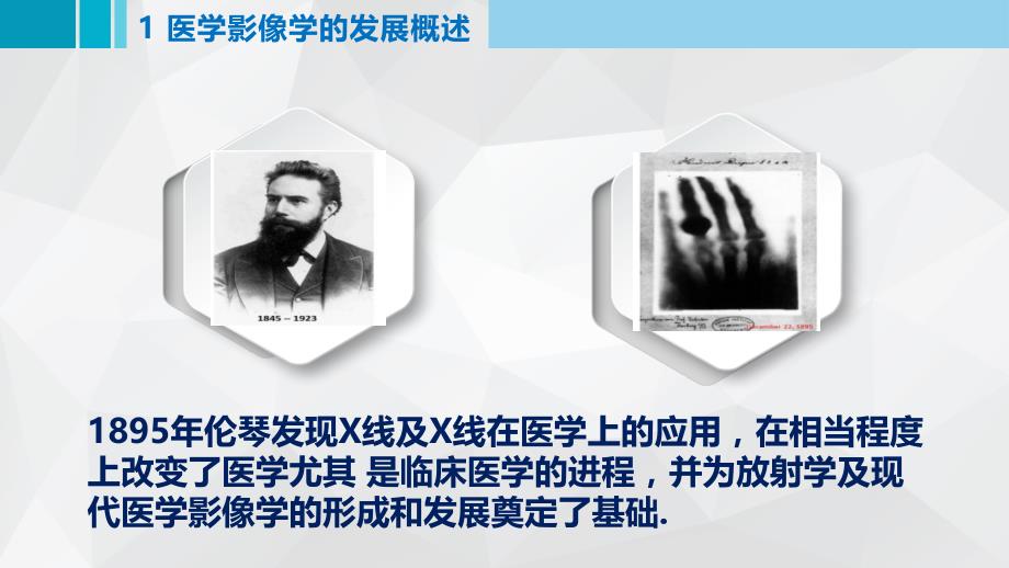 医学影像学发展史_第4页