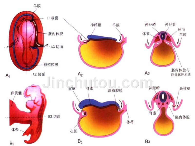 胎儿前腹壁畸形超声诊断-吴向东-2015.04.16_第4页