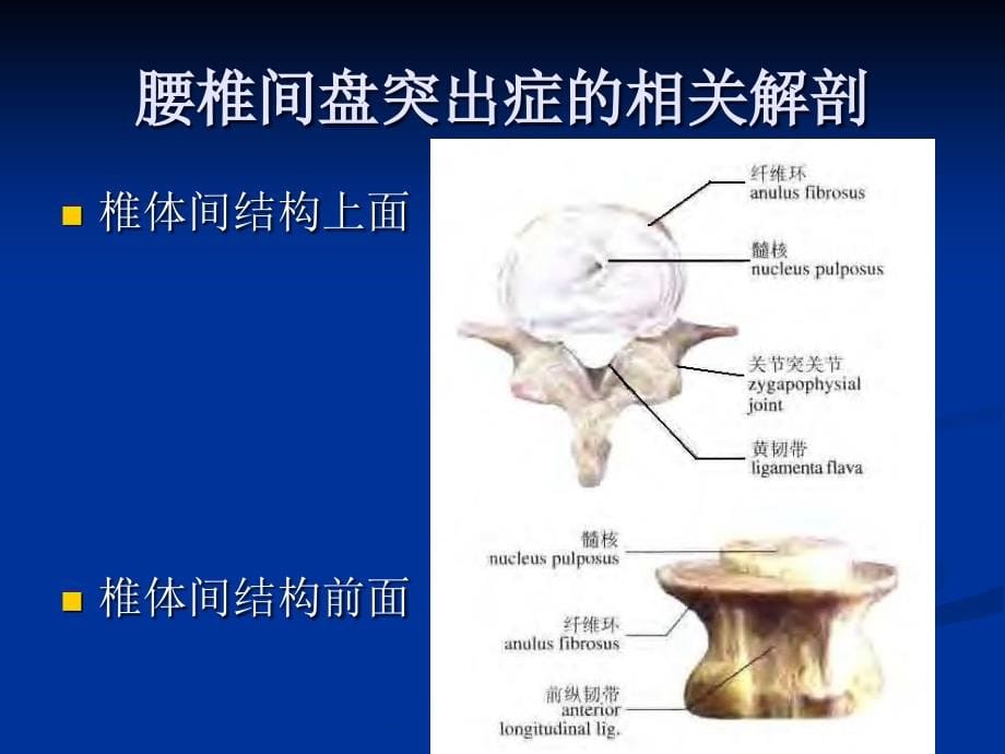 腰椎间盘突出症的诊断、鉴别诊断与分型15438_第5页