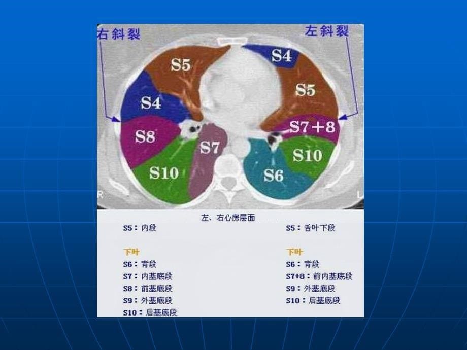 胸部CT肺段图解_第5页