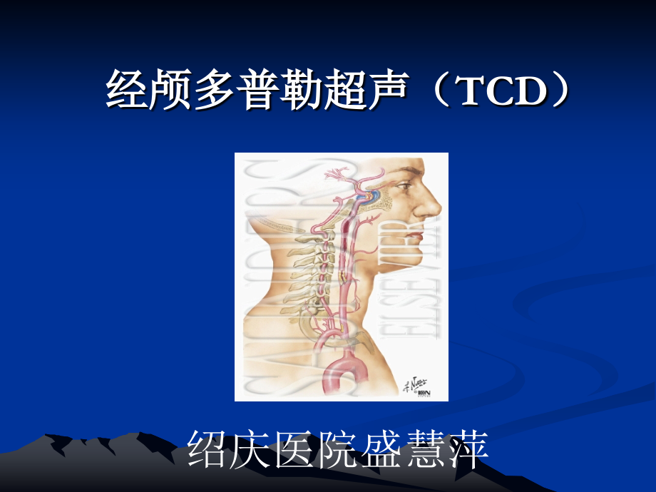 经颅多普勒(TCD)讲解03937_第1页