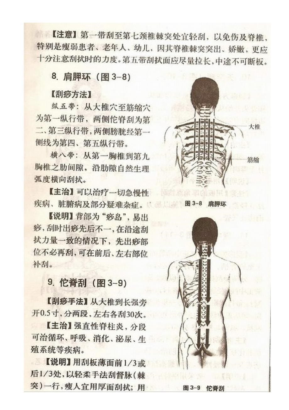 刮痧全图_第5页