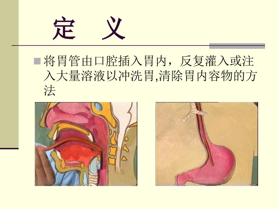 洗胃法操作.._第4页