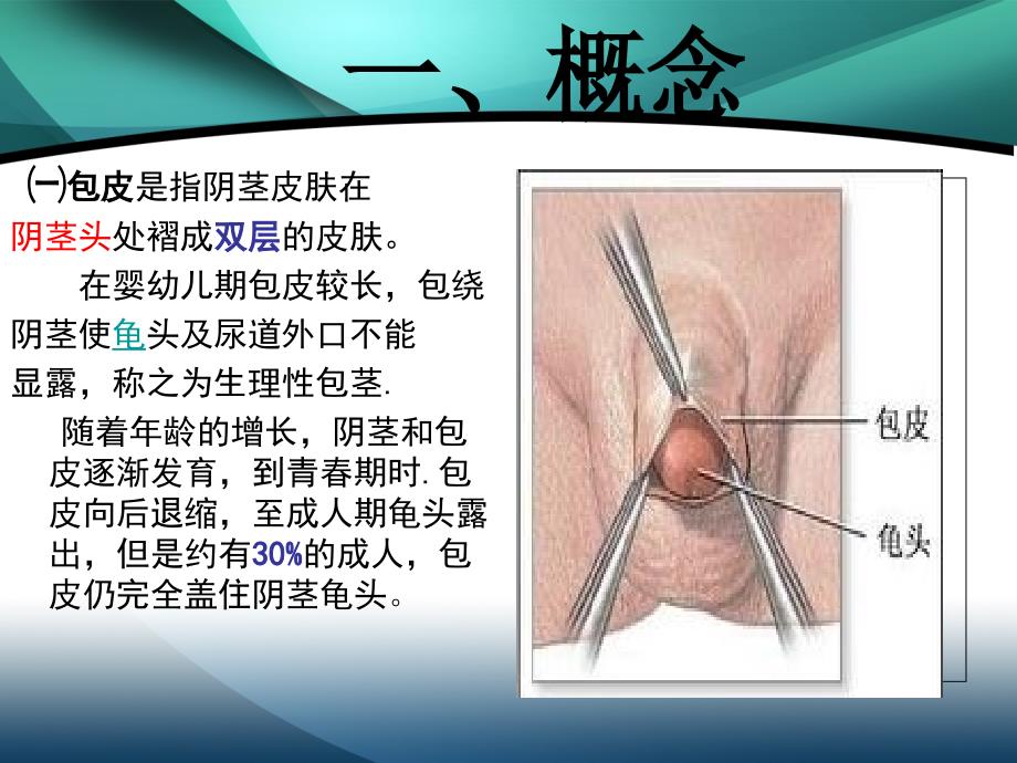 包皮包茎课件_第3页