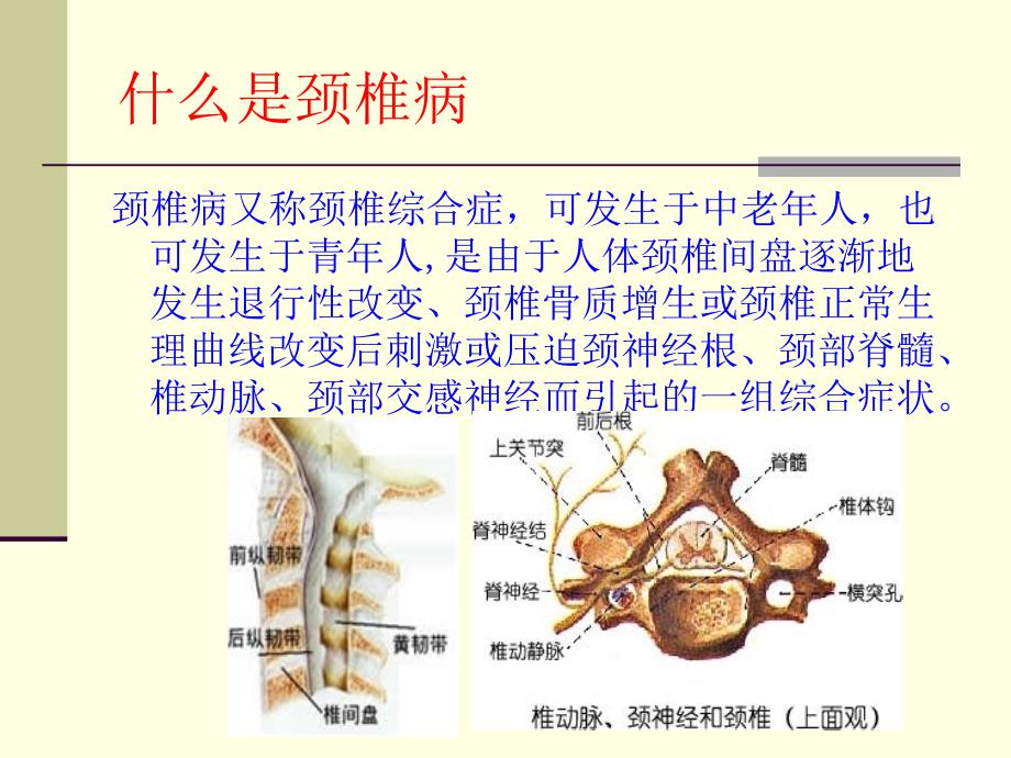 颈椎病及电脑综合病的防治_第4页