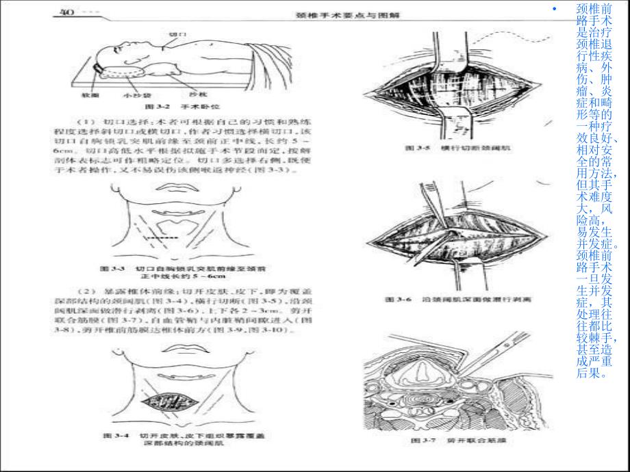 颈椎前路术后并发症及护理措施_第2页