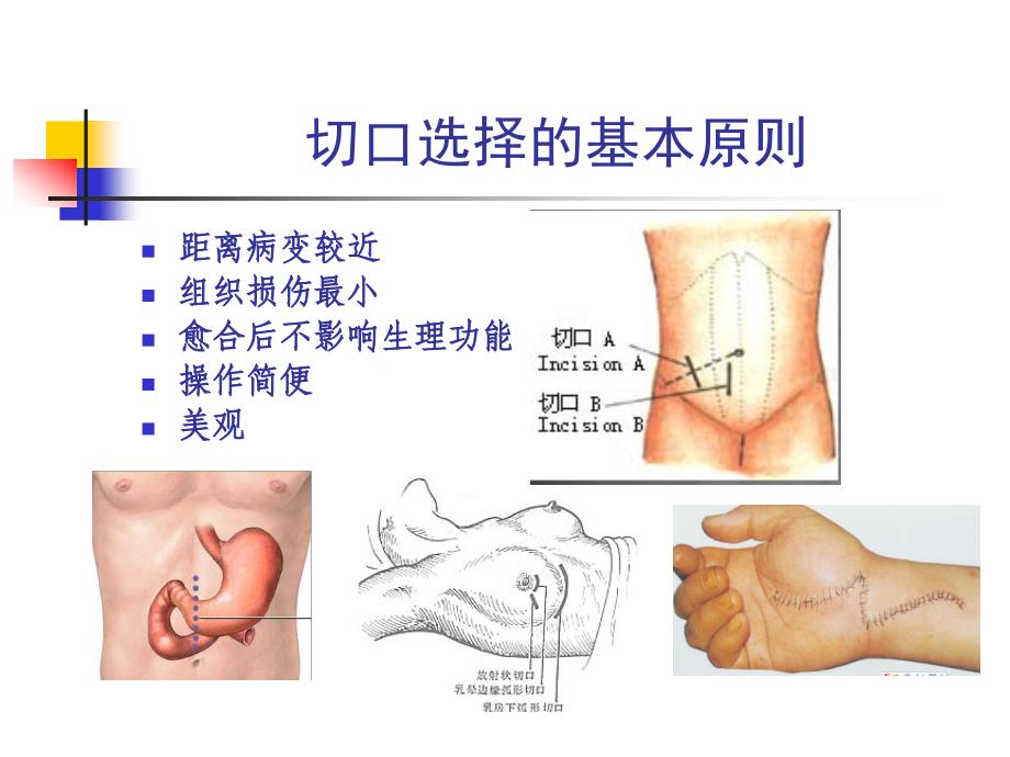 外科手术基本技术_图文_第3页