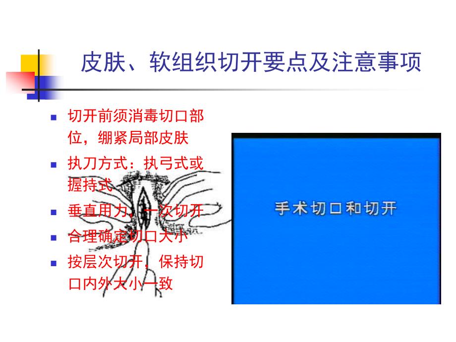 外科手术基本技术_图文_第4页