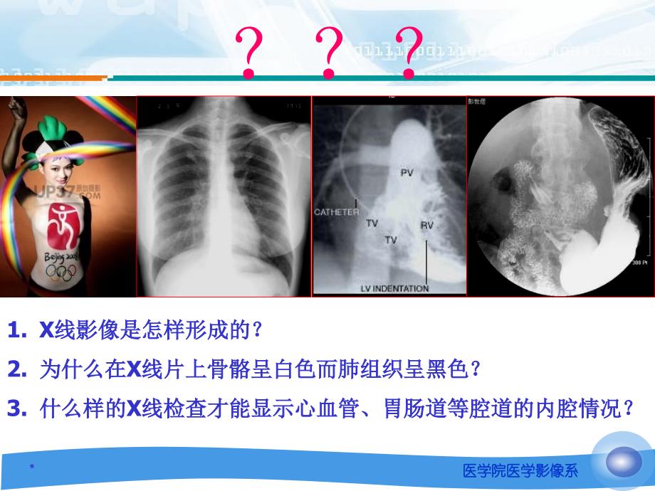 医学影像学总论之一X线诊断学_第2页