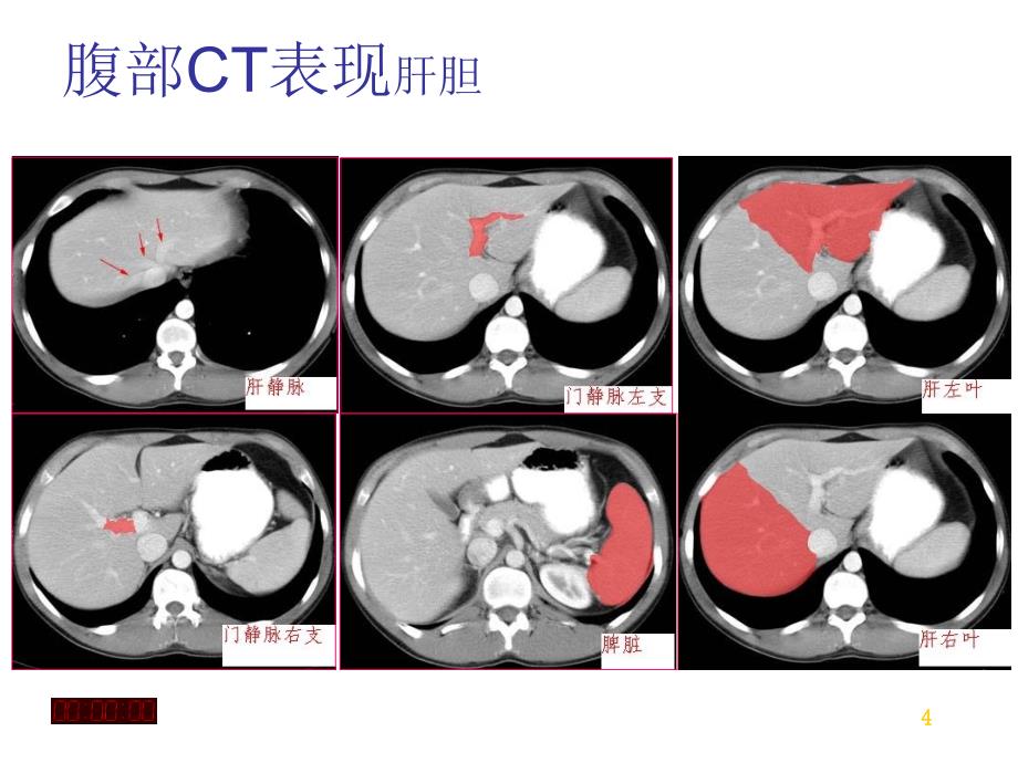 放射科急腹症读片_第4页