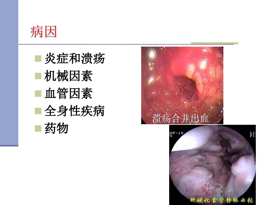 急诊科消化系统急症_第3页