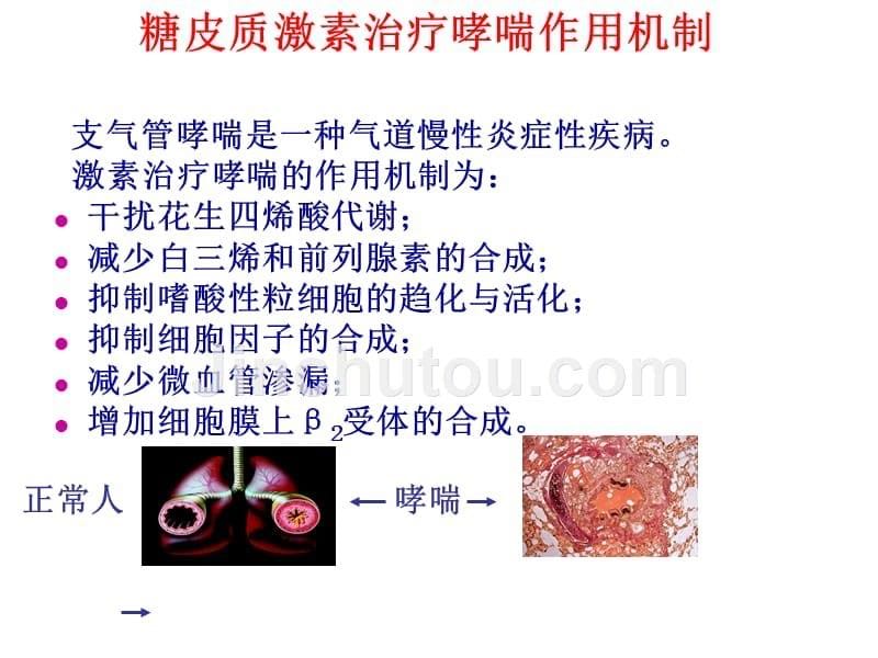 激素在呼吸系统疾病应用-刘又宁_第5页