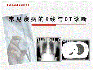 常见的x线和ct诊断-课件(头,胸、腹、四肢)-培训讲座