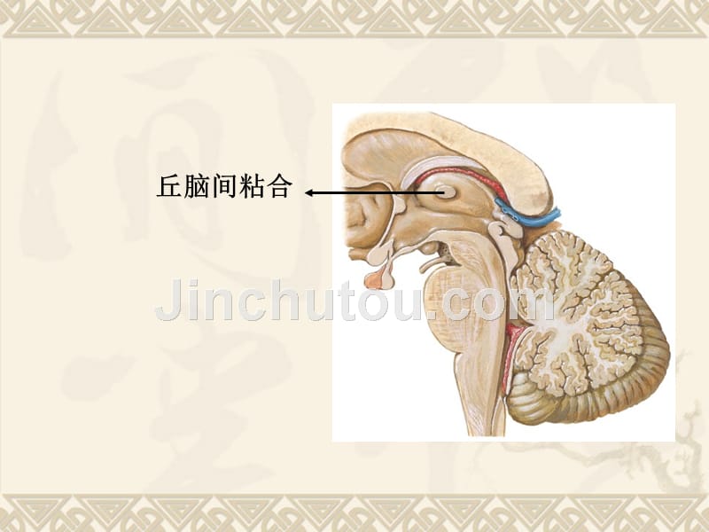 实验14.间脑端脑_第4页