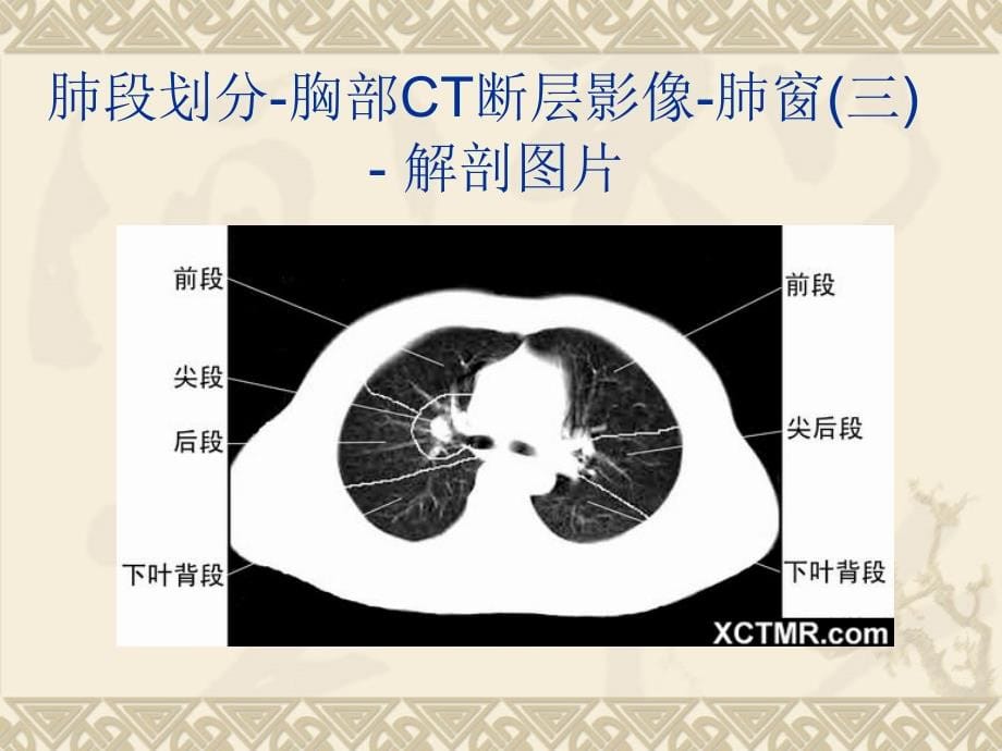 全身CT断层解剖详细 实用 图解_第5页